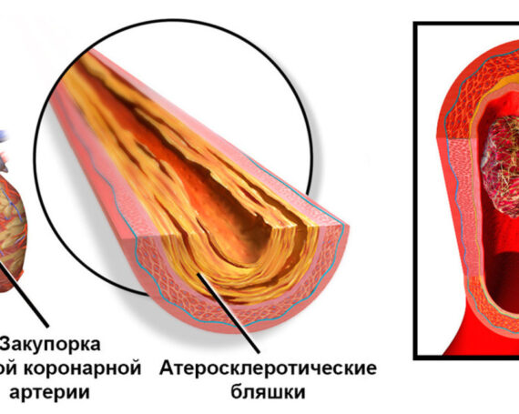 История